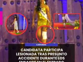 CARUMAS | ¡PREOCUPACIÓN EN CERTAMEN SEÑORITA CARUMAS! CANDIDATA PARTICIPA LESIONADA TRAS PRESUNTO ACCIDENTE DURANTE LOS ENSAYOS EN EL ESTRADO