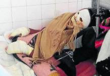 PUNO: UNIVERSITARIO SE SALVA DE MORIR EN INCENDIO DEBIDO A FUGA DE GAS