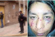 PUNO: MUJER LE DESFIGURA ROSTRO A SU PAREJA POR IRSE DE FIESTA EN JULIACA