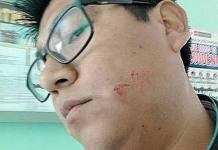 TACNA: EXSUBPREFECTO AGREDE A PERIODISTA POR FILMAR REUNIÃ“N EN MUNICIPIO