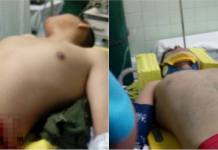 AREQUIPA: DOS POLICÃAS JÃ“VENES QUEDAN GRAVES TRAS CHOQUE EN MOTOCICLETA