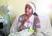 PUNO: ESTUDIANTE DE UANCV JULIACA ES AGREDIDA POR PAREJA