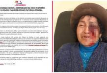 CUSCO: LAS BAMBAS LLAMA AL DIÃLOGO LUEGO DE ENFRENTAMIENTO QUE DEJÃ“ A COMUNERA PARCIALMENTE CIEGA