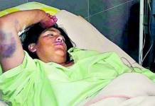 PUNO: DENUNCIAN QUE FISCALÃA DEJÃ“ EN LIBERTAD A CHOFER QUE ATROPELLÃ“ A MADRE E HIJA EN PUTINA