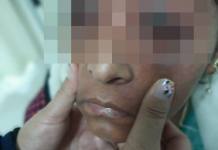 APURIMAC: HOMBRE DEJA GRAVE A SU EXPAREJA TRAS AHORCARLA