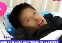 TORATA: NIÃ‘O DE 12 AÃ‘OS CON TUMOR EN LA CABEZA LUCHA POR SU VIDA TRAS DELICADA OPERACIÃ“N EN LIMA