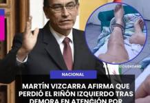 MARTÍN VIZCARRA AFIRMA QUE PERDIÓ EL RIÑÓN IZQUIERDO TRAS DEMORA EN ATENCIÓN POR CÓLICO RENAL