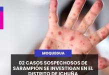 MOQUEGUA | 02 CASOS SOSPECHOSOS DE SARAMPIÓN SE INVESTIGAN EN EL DISTRITO DE ICHUÑA.