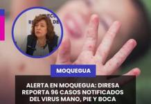 MOQUEGUA | ALERTA EN MOQUEGUA: DIRESA REPORTA 96 CASOS NOTIFICADOS DEL VIRUS MANO, PIE Y BOCA.