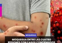 MOQUEGUA | MOQUEGUA ENTRE LAS CUATRO REGIONES CON CASOS CONFIRMADOS DE SARAMPIÓN EN EL PAÍS.