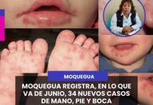 MOQUEGUA | MOQUEGUA REGISTRA, EN LO QUE VA DE JUNIO, 34 NUEVOS CASOS DE MANO, PIE Y BOCA.