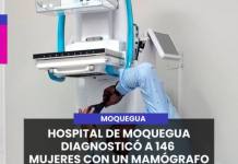 MOQUEGUA | HOSPITAL DE MOQUEGUA DIAGNOSTICÓ A 146  MUJERES CON UN MAMÓGRAFO MALOGRADO.